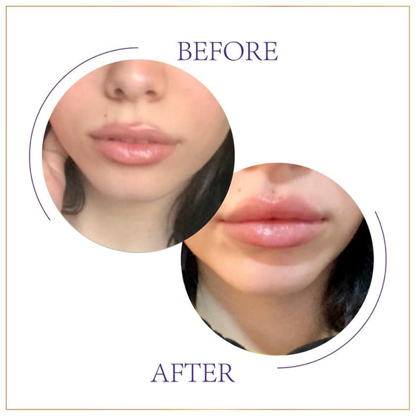 Volume Lip Therapy - Trixsent Beauty Care 